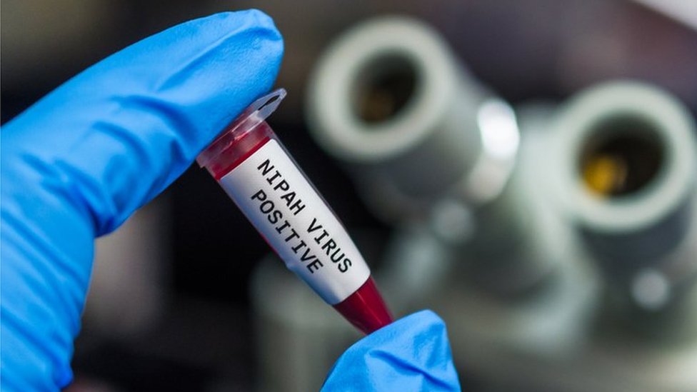 Alerta Global: Vírus Nipah ressurge na Índia com alta letalidade e coloca aeroportos em alerta máximo